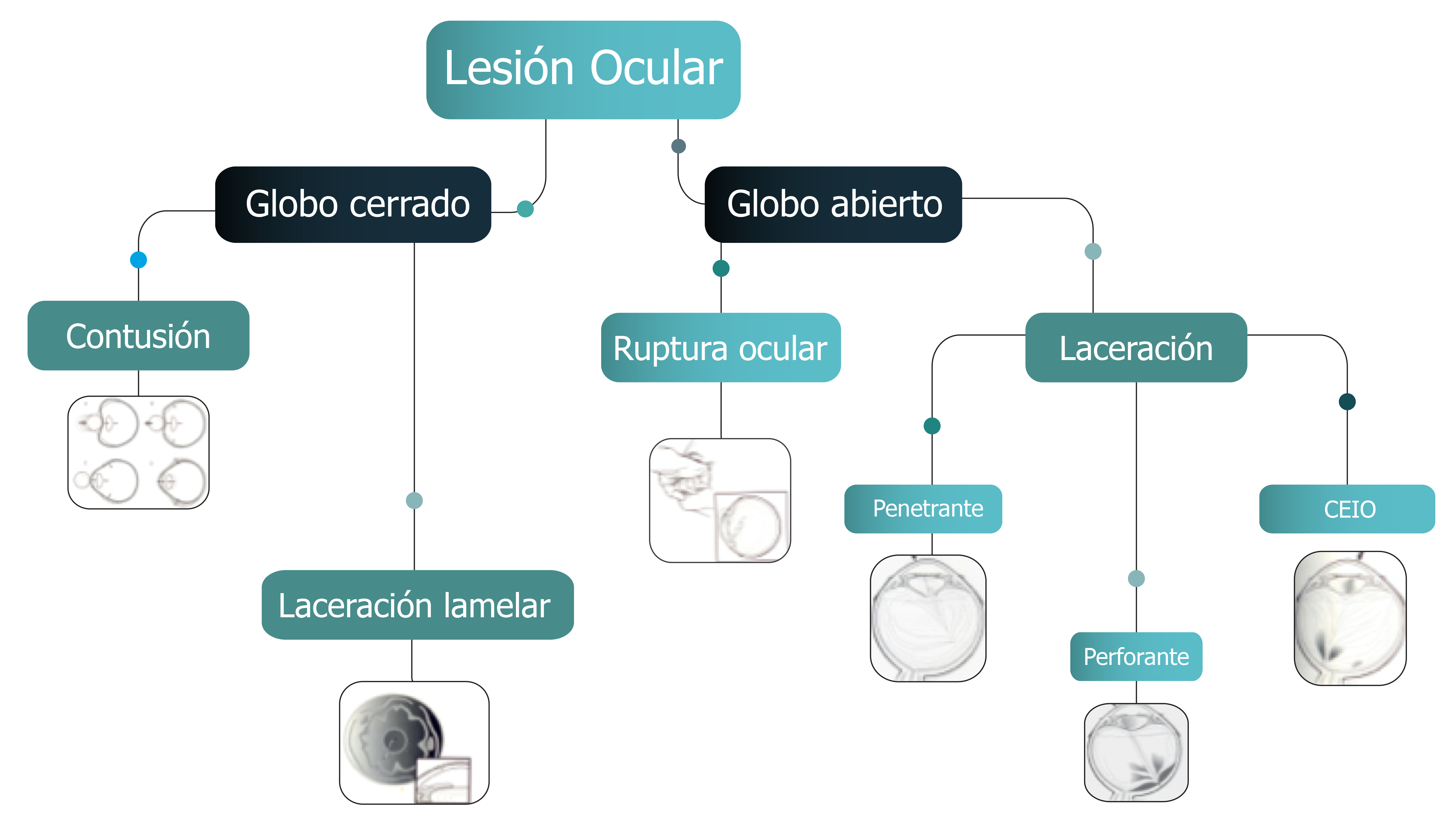 lesion ocular